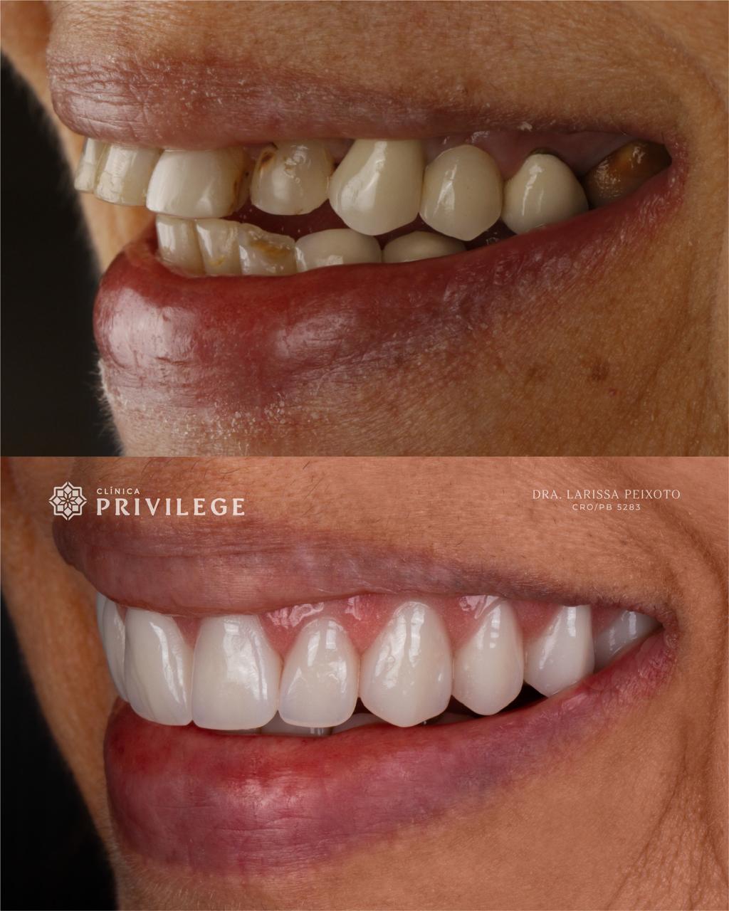 Before and after treatment