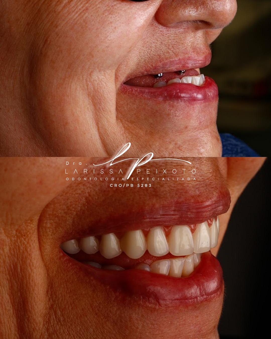 Before and after treatment