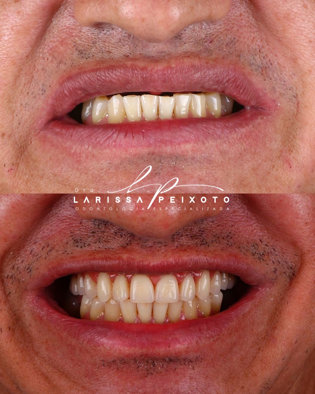 Before and after treatment